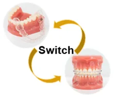 治療装置切り替えの写真